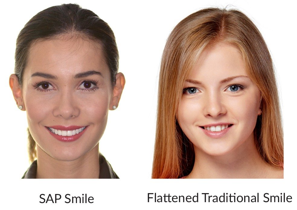 SAP-vs-Traditional-Smile-1 SAP versus traditional smile side by side
