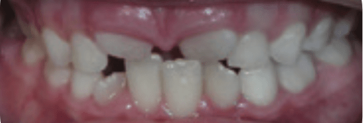 Before-Phase-1-Treatment- Before-Phase-1-Treatment-