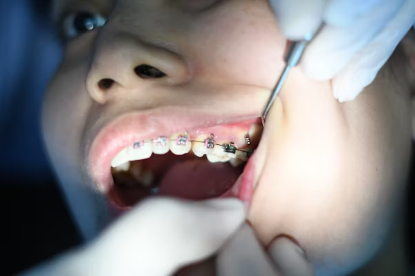 Child with braces on their teeth with a dentist using a tool to examine the mouth.