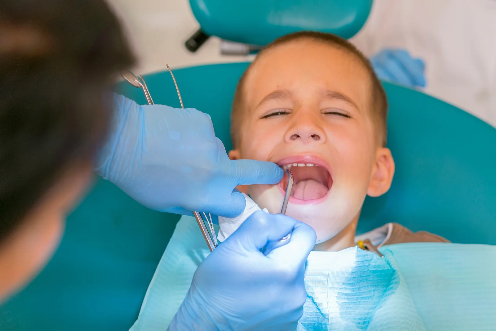 A young boy lying in a dental chair with his mouth open during an exam.